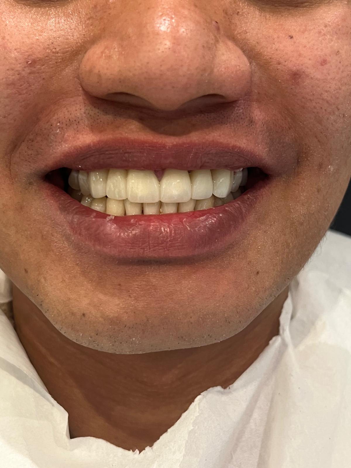ECE Dental Patient Transformation
